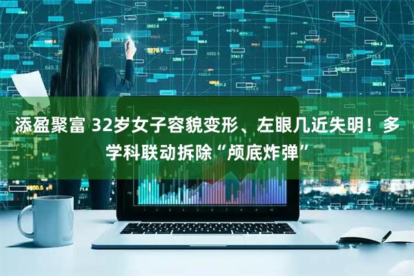 添盈聚富 32岁女子容貌变形、左眼几近失明！多学科联动拆除“颅底炸弹”